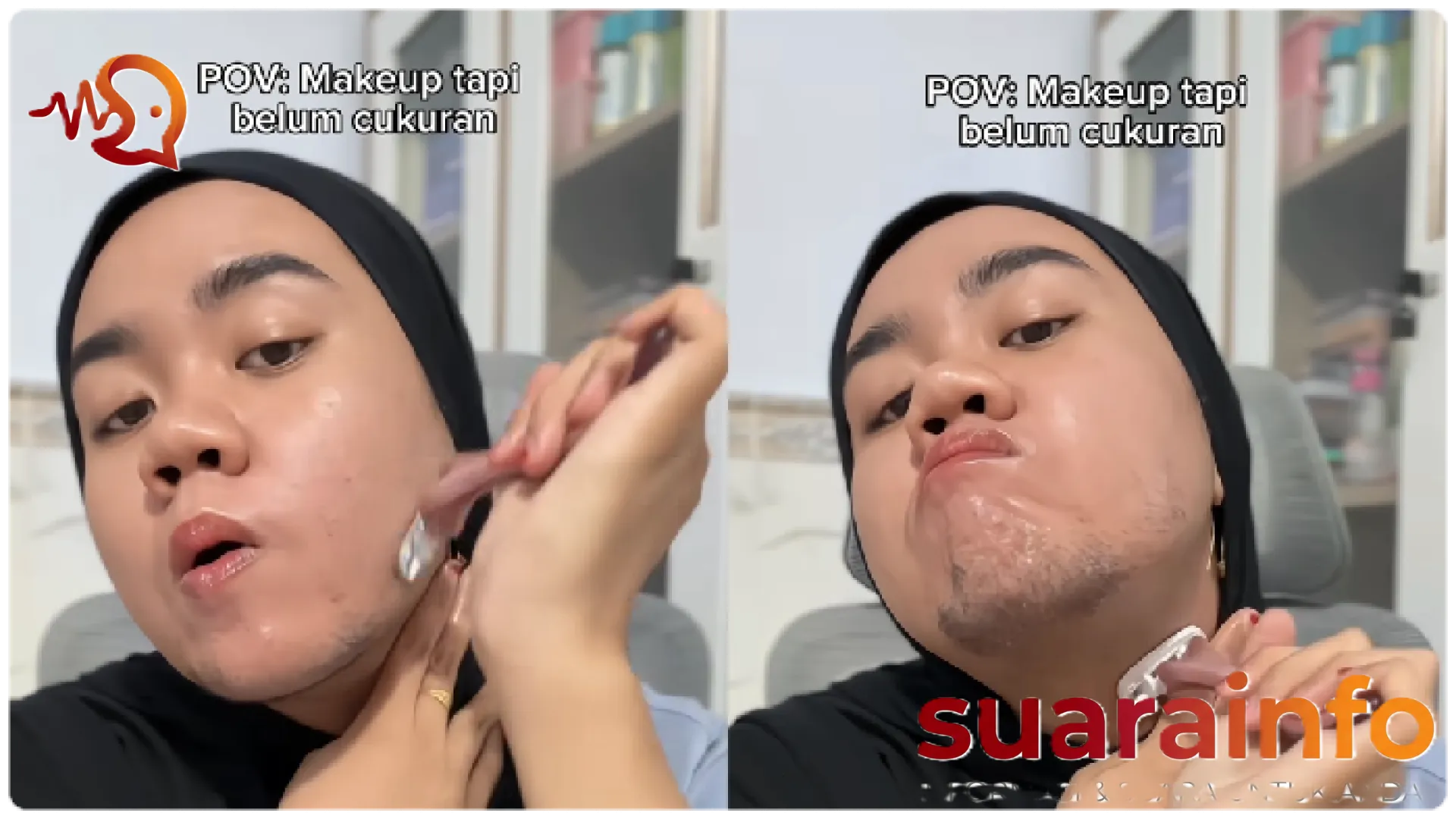 Kisah Viral Sahriyah, Gadis Madura dengan Kondisi Brewok Langka: Perjuangan Melawan Tumor dan Kelumpuhan
