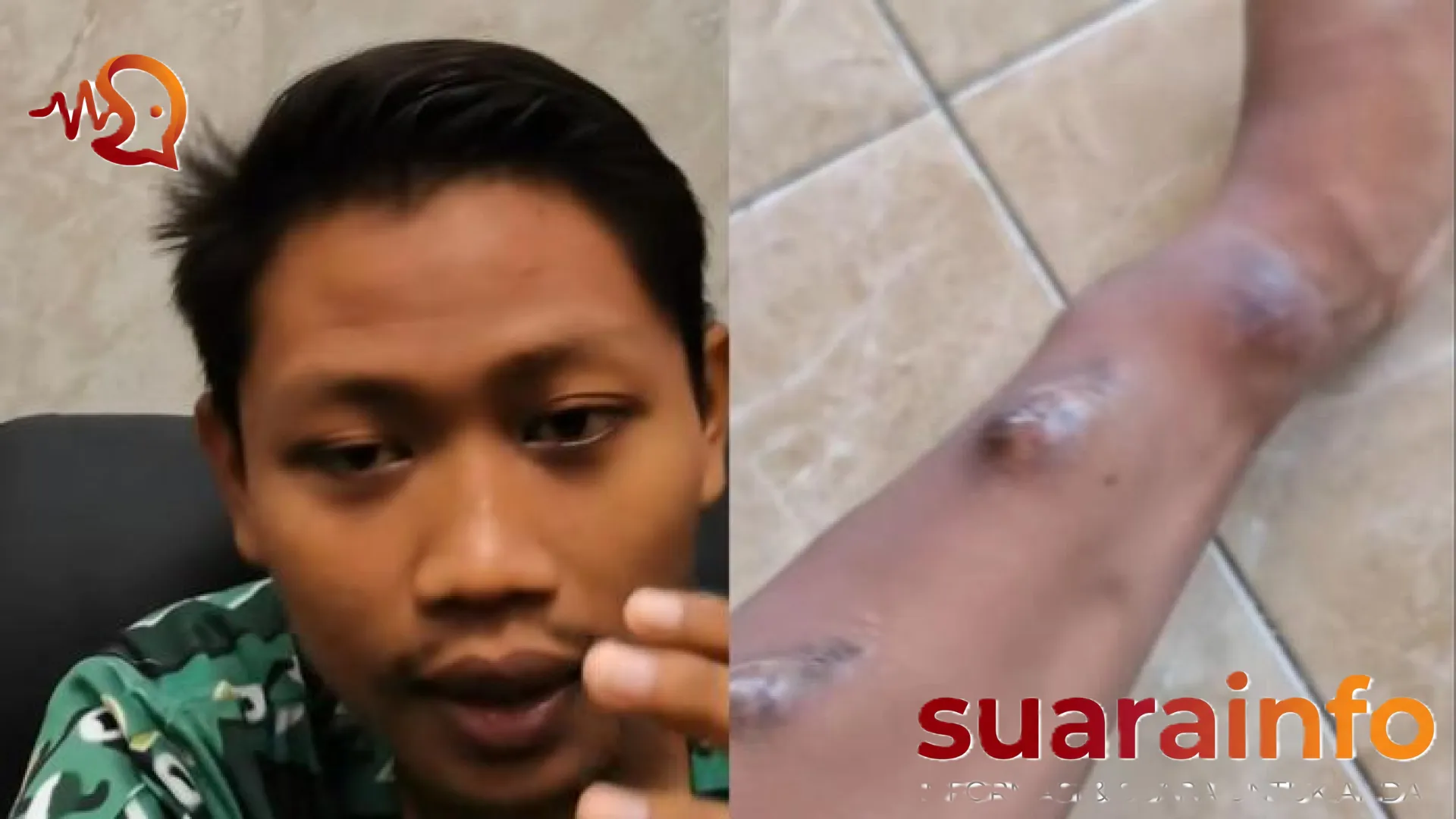 Kisah Pilu Edi Utomo: Berjuang Melawan Gagal Ginjal di Usia Muda Akibat Pola Makan, Nyaris 700 Kali Cuci Darah