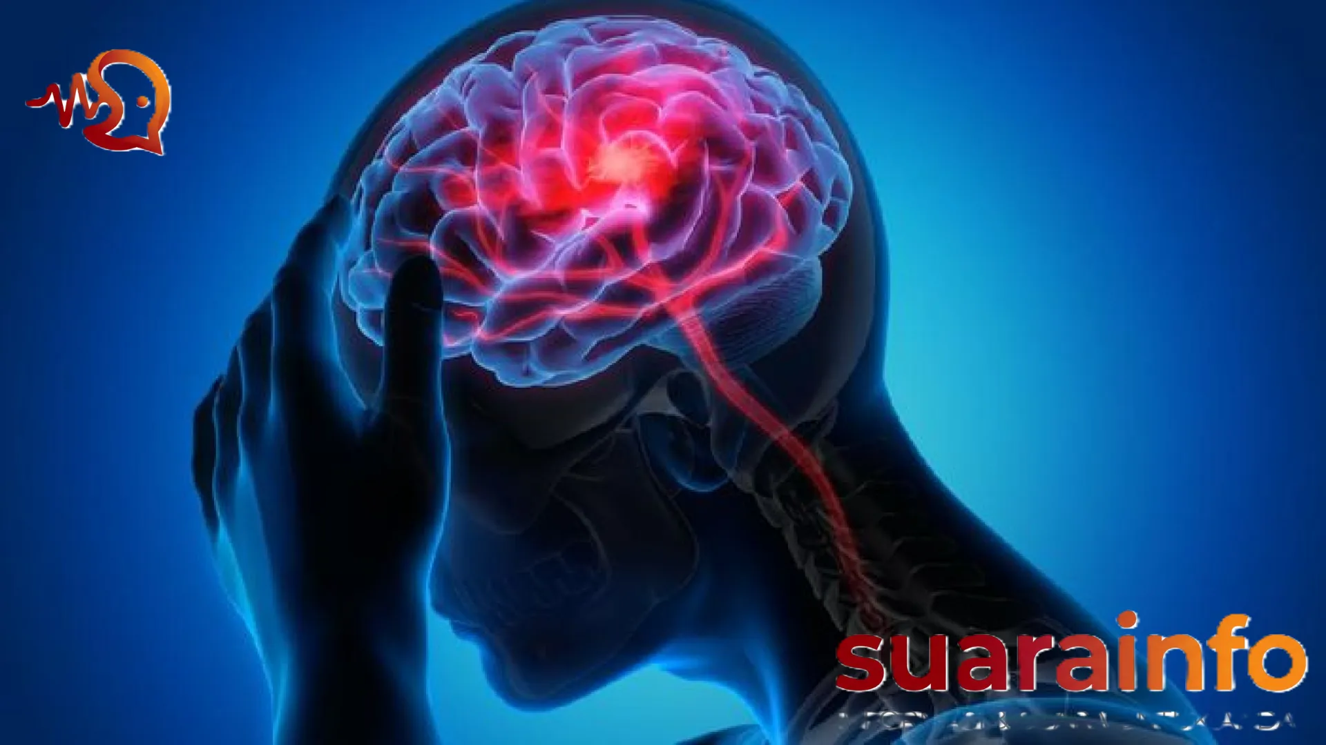 Stroke Bukan Lagi Penyakit Lansia: Dokter Saraf Peringatkan Gejala Tersembunyi yang Mengintai Anak Muda