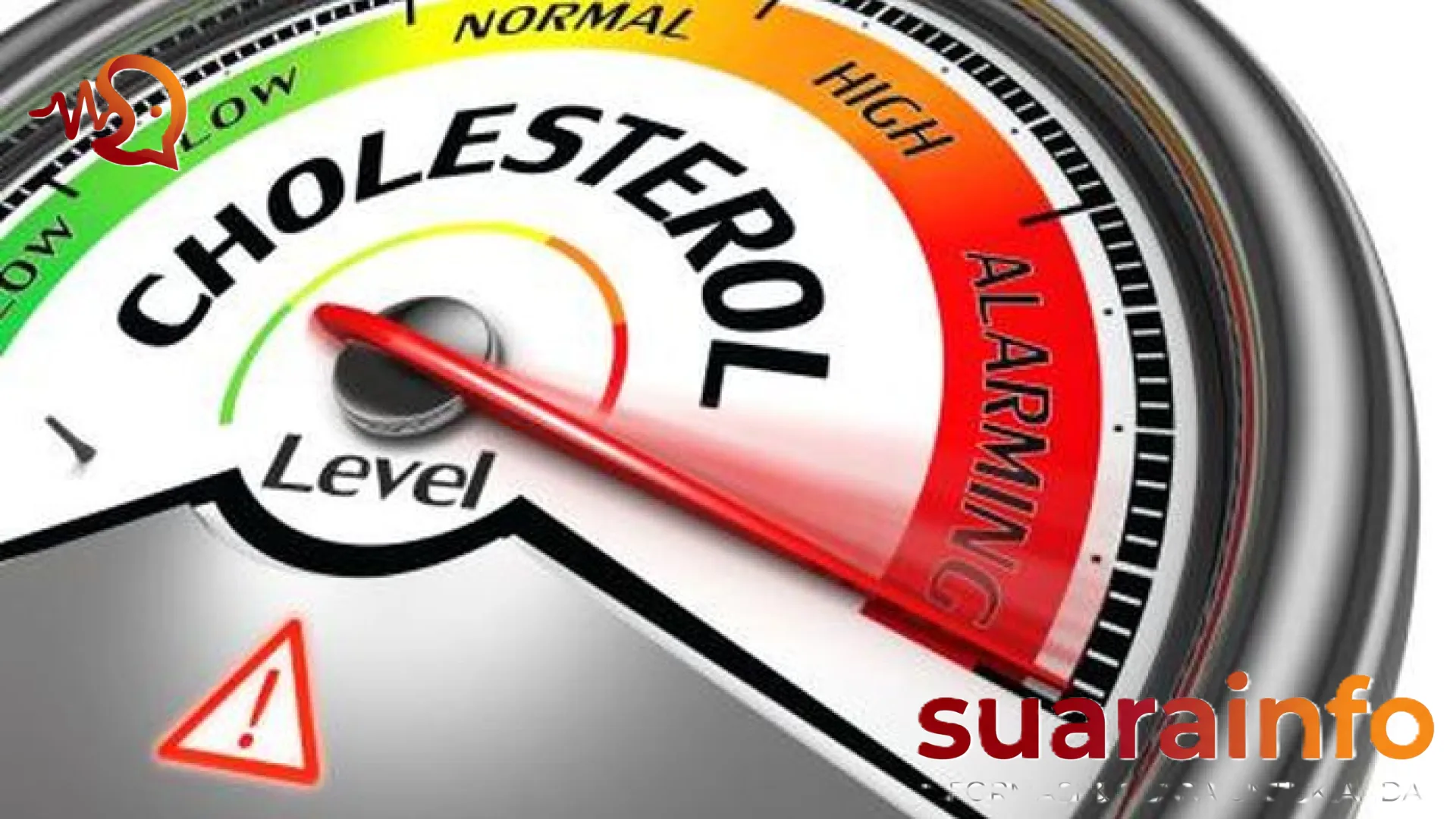 Waspadai Benjolan di Kaki: Tanda Kolesterol Tinggi yang Sering Terabaikan dan Risiko Fatal Jantung