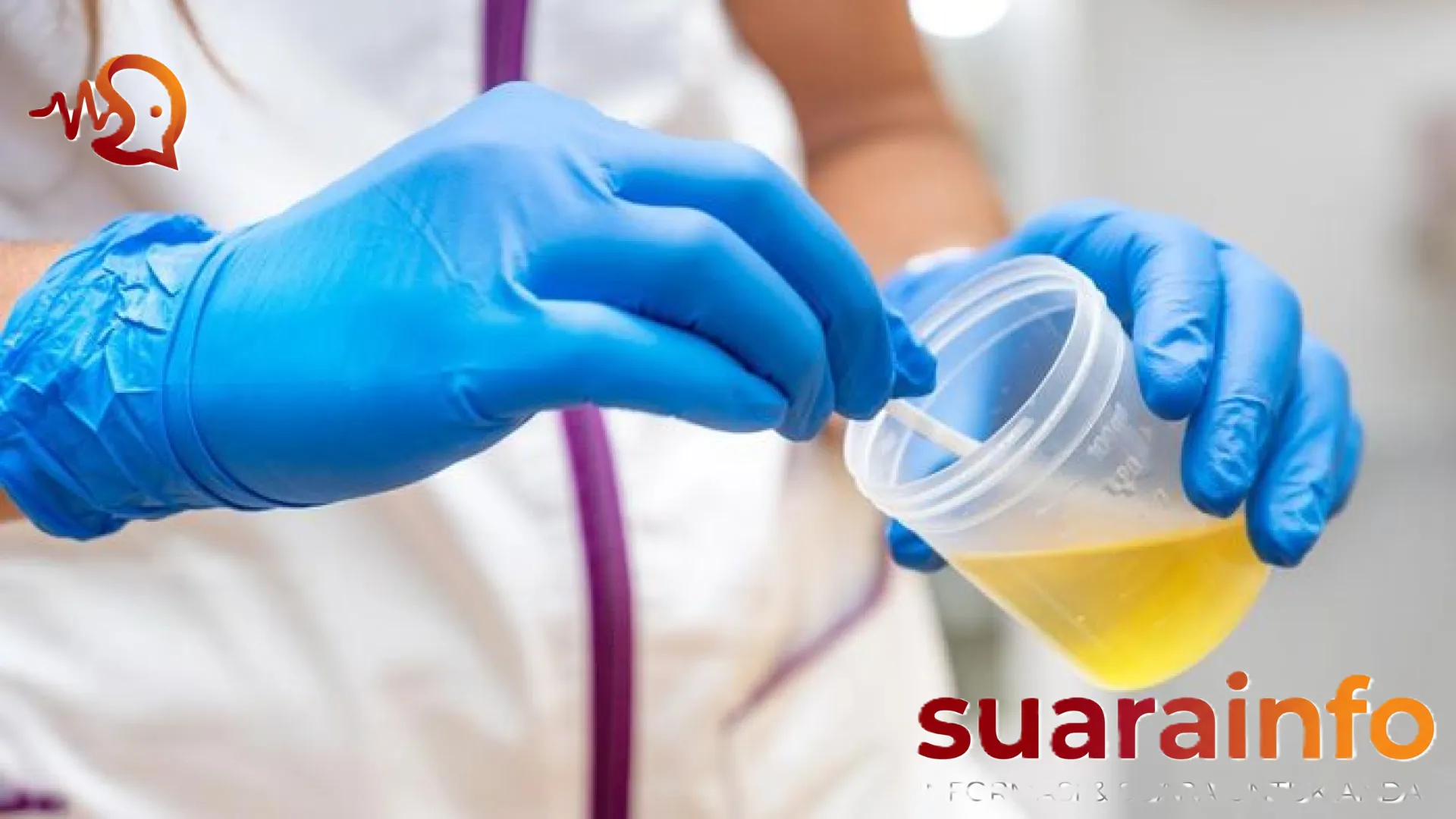 Waspadai Sinyal Bahaya: Kenali Gejala Ginjal Rusak Lewat Perubahan Urine Anda