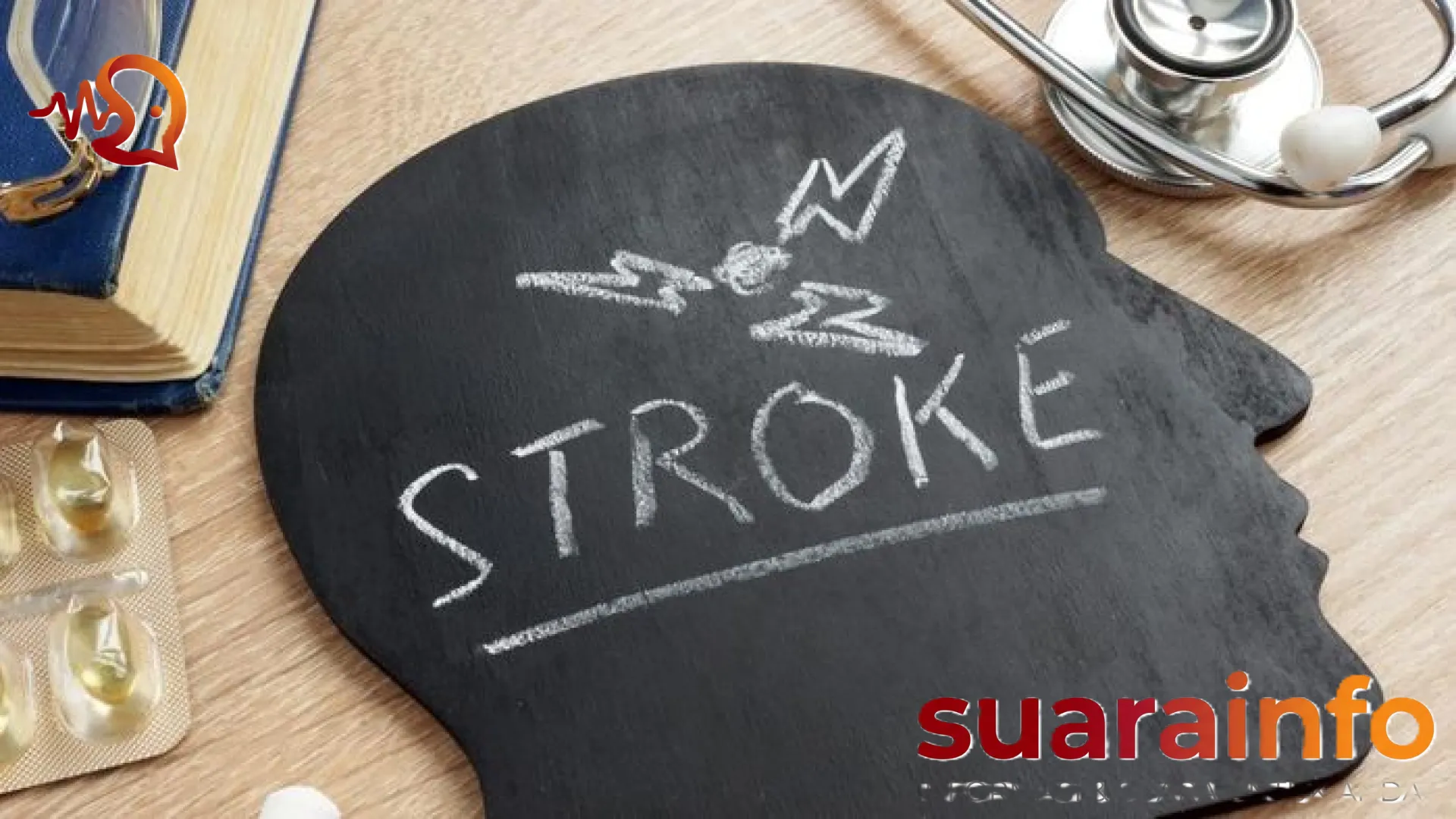 Kisah Haru Camila, Bocah 11 Tahun yang Terserang Stroke Mendadak di Sekolah: Waspada Bahaya Komplikasi Virus